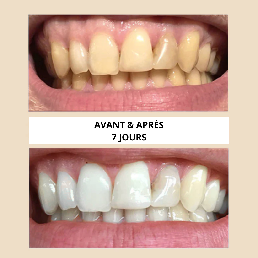 Siwak- Blanchisseur Dentaire Naturel